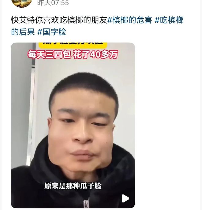 成方块脸吃了40多万网友都不敢信！爱游戏体育太吓人！小伙吃槟榔8年(图6)
