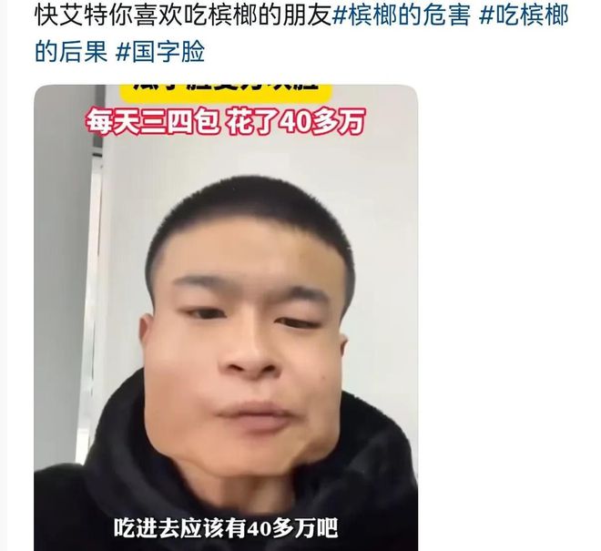 成方块脸吃了40多万网友都不敢信！爱游戏体育太吓人！小伙吃槟榔8年(图4)