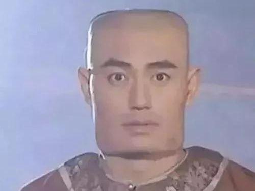 成方块脸吃了40多万网友都不敢信！爱游戏体育太吓人！小伙吃槟榔8年(图7)