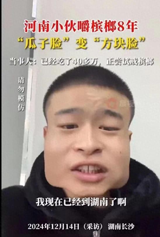 成方块脸吃了40多万网友都不敢信！爱游戏体育太吓人！小伙吃槟榔8年(图8)